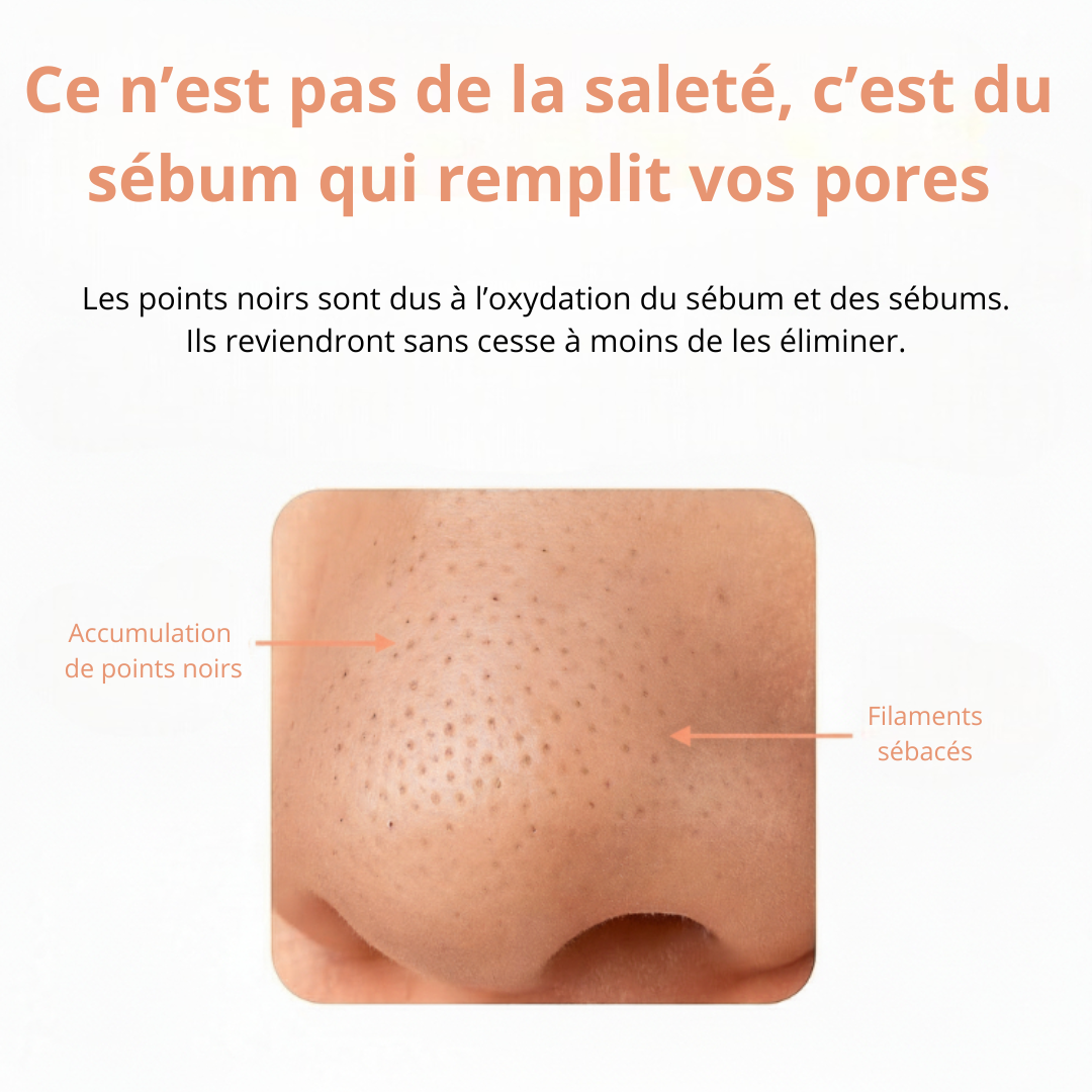 PortiClean- Nettoyeur de pore